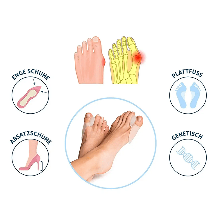 Orthopädischer Hallux Zehenspreizer Silikon Überzieher (2er Set) – Bild 3
